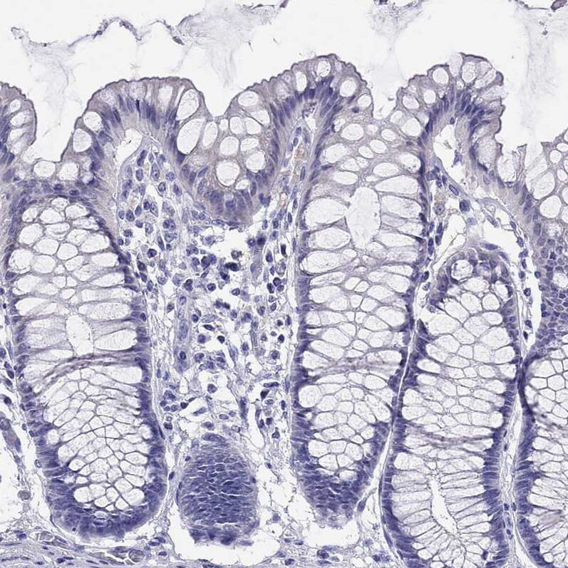 LRIT2 Antibody - BSA Free Immunohistochemistry: LRIT2 Antibody - BSA Free [NBP1-90876]
