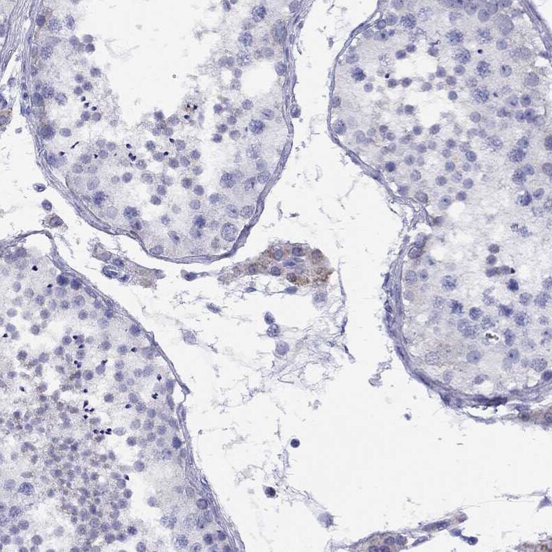 LRIT2 Antibody - BSA Free Immunohistochemistry: LRIT2 Antibody - BSA Free [NBP1-90876]