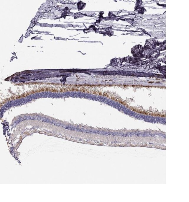 LRIT2 Antibody - BSA Free Immunohistochemistry: LRIT2 Antibody - BSA Free [NBP1-90876]