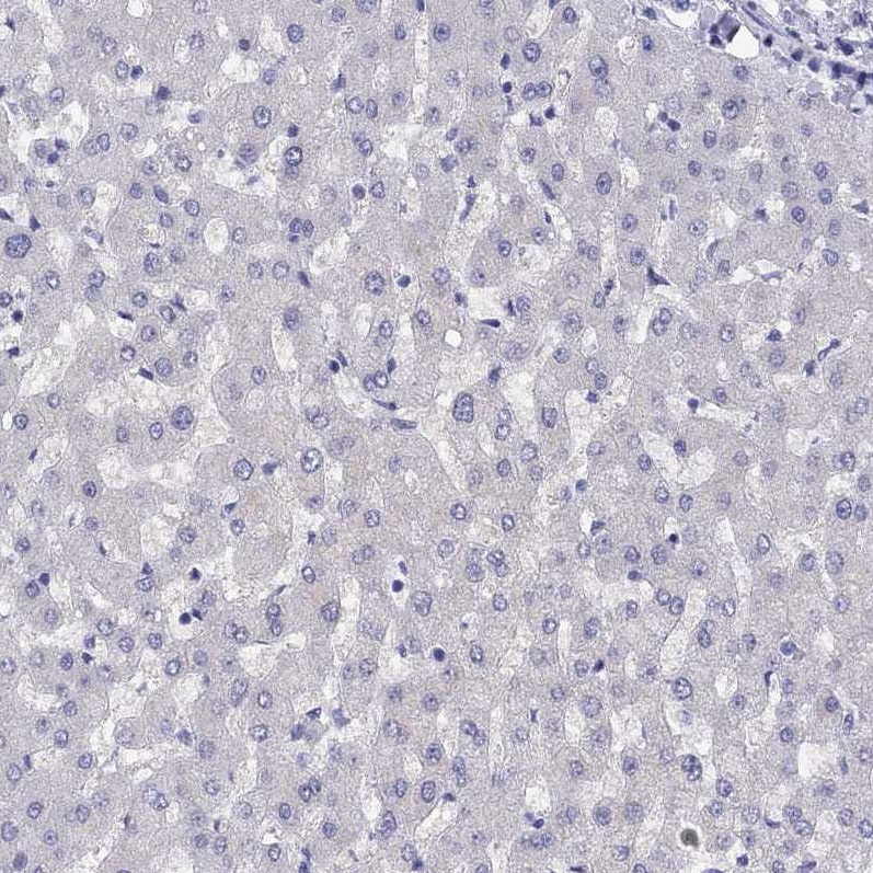 LRIT2 Antibody - BSA Free Immunohistochemistry: LRIT2 Antibody - BSA Free [NBP1-90876]