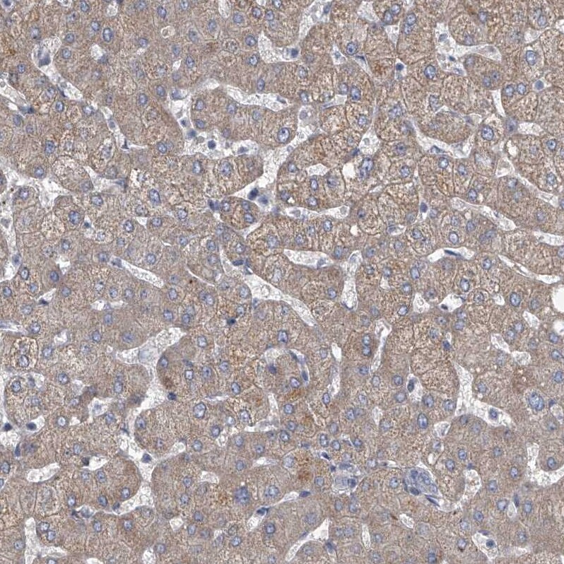 HEATR6 Antibody - BSA Free Immunohistochemistry: HEATR6 Antibody - BSA Free [NBP1-90877]