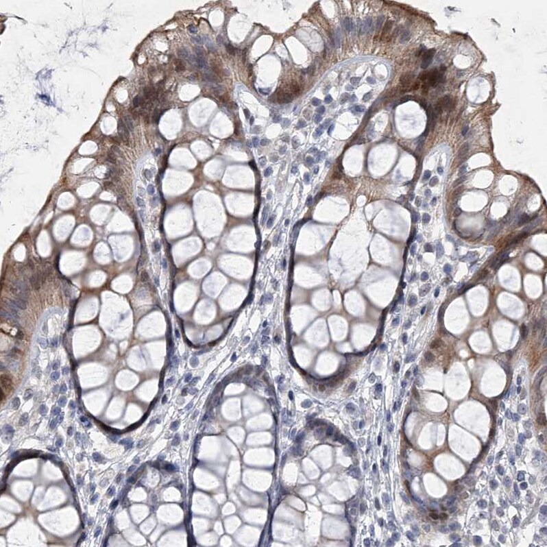 HEATR6 Antibody - BSA Free Immunohistochemistry: HEATR6 Antibody - BSA Free [NBP1-90877]