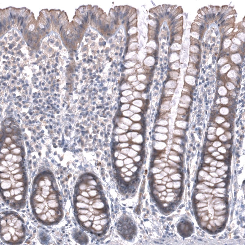 ZSWIM8 Antibody - BSA Free Immunohistochemistry: ZSWIM8 Antibody - BSA Free [NBP1-90878]