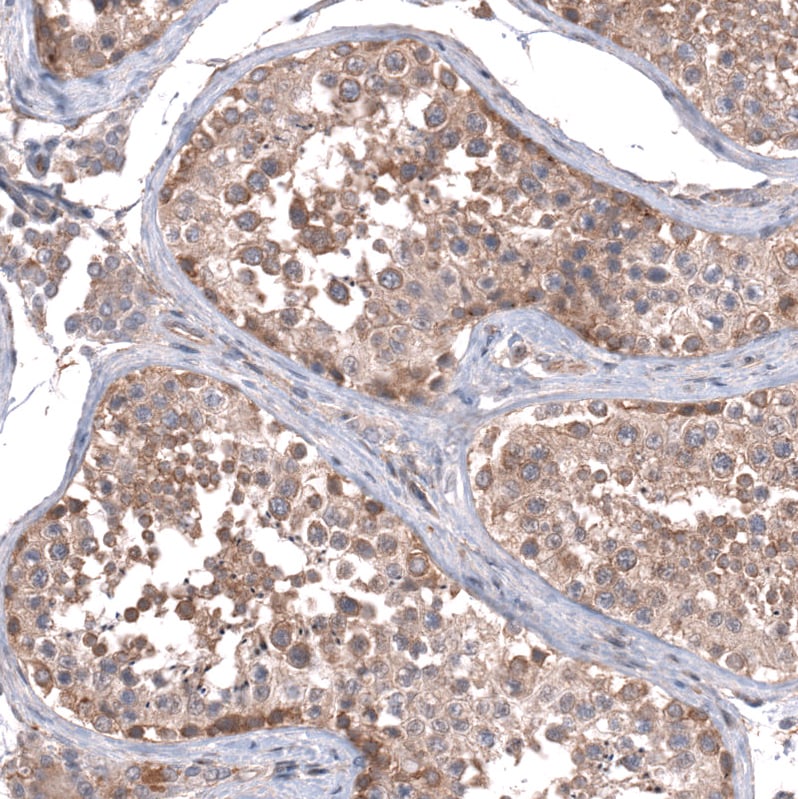 ZSWIM8 Antibody - BSA Free Immunohistochemistry: ZSWIM8 Antibody - BSA Free [NBP1-90878]