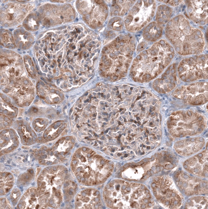 ZSWIM8 Antibody - BSA Free Immunohistochemistry: ZSWIM8 Antibody - BSA Free [NBP1-90878]