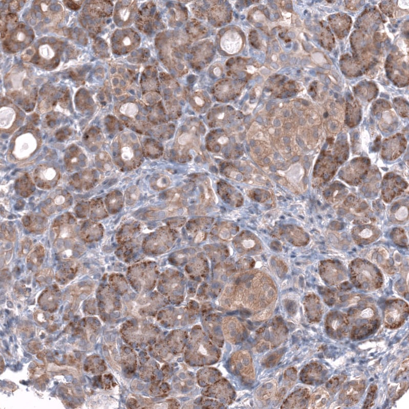 ZSWIM8 Antibody - BSA Free Immunohistochemistry: ZSWIM8 Antibody - BSA Free [NBP1-90878]