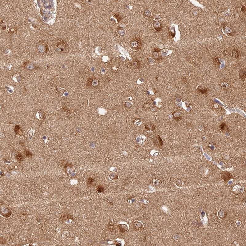 LRRC68 Antibody - BSA Free Immunohistochemistry-Paraffin: LRRC68 Antibody [NBP1-90889]