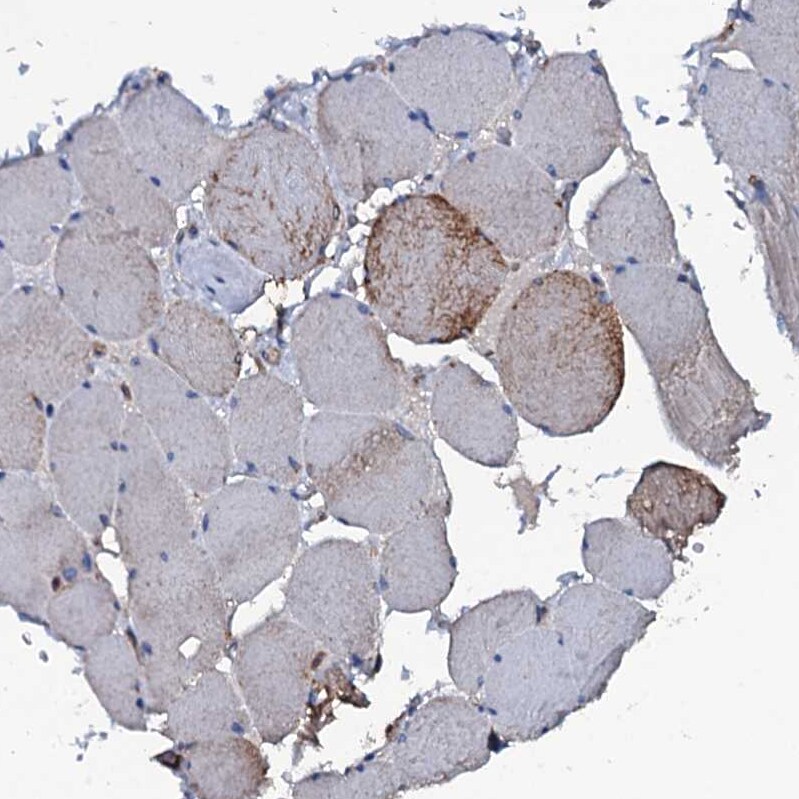 MS4A4E Antibody - BSA Free Immunohistochemistry-Paraffin: MS4A4E Antibody [NBP1-90895]