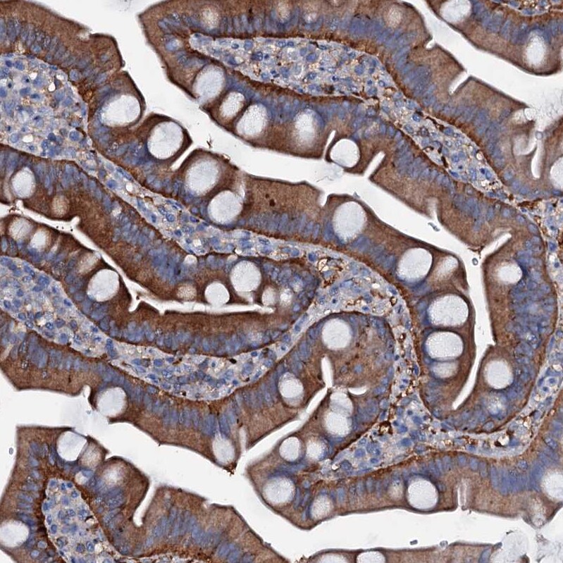 MS4A4E Antibody - BSA Free Immunohistochemistry-Paraffin: MS4A4E Antibody [NBP1-90895]