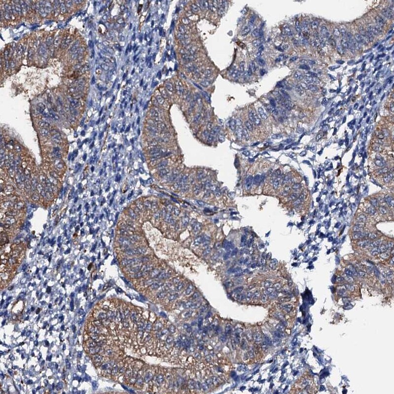 MS4A4E Antibody - BSA Free Immunohistochemistry-Paraffin: MS4A4E Antibody [NBP1-90895]