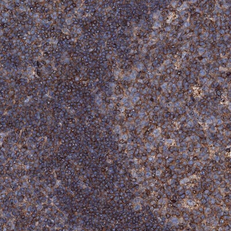 MS4A4E Antibody - BSA Free Immunohistochemistry: MS4A4E Antibody - BSA Free [NBP1-90895]