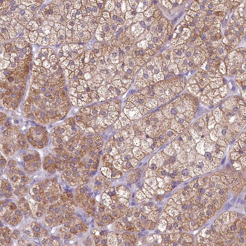 MRP63 Antibody - BSA Free Immunohistochemistry: MRP63 Antibody - BSA Free [NBP1-90898]