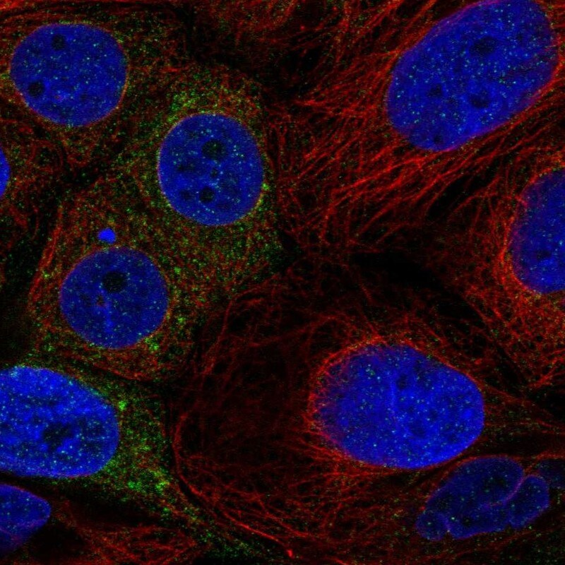 PSAPL1 Antibody - BSA Free Immunocytochemistry/ Immunofluorescence: PSAPL1 Antibody [NBP1-90903]
