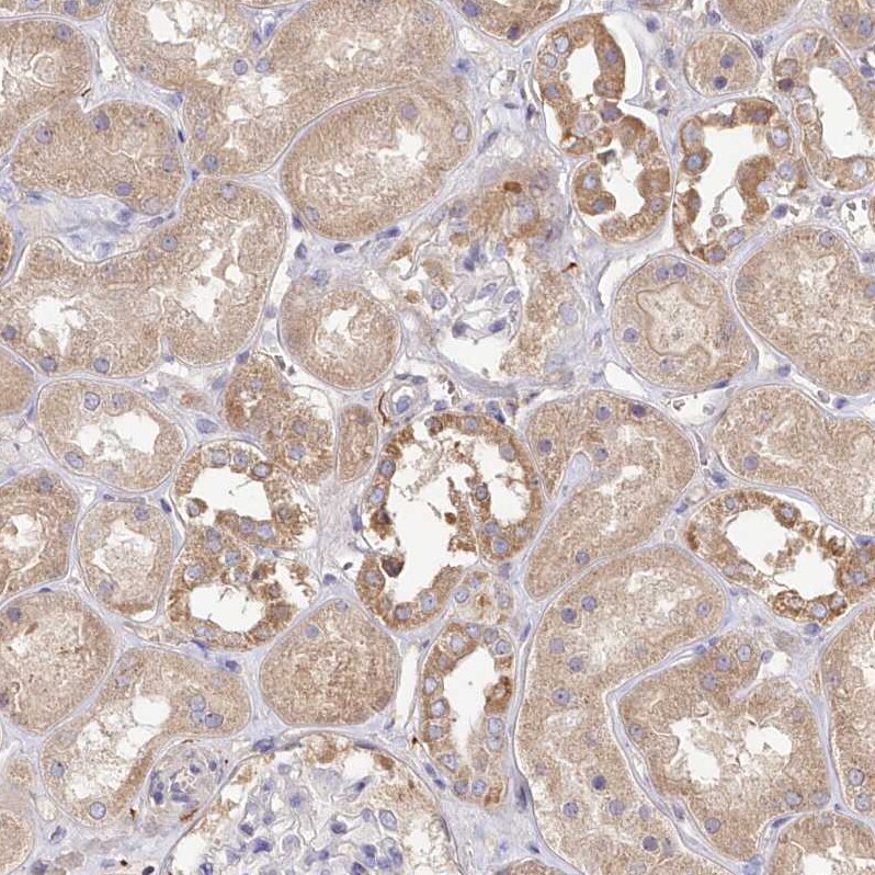 FCHO2 Antibody - BSA Free Immunohistochemistry: FCHO2 Antibody - BSA Free [NBP1-90904]