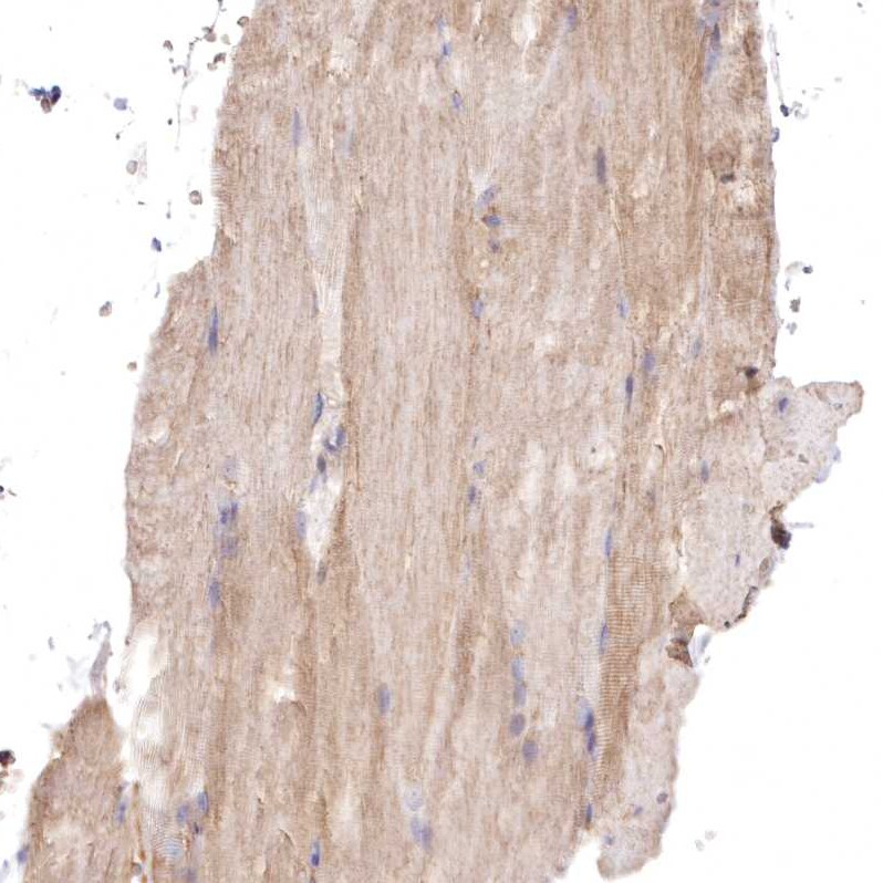FCHO2 Antibody - BSA Free Immunohistochemistry: FCHO2 Antibody - BSA Free [NBP1-90904]