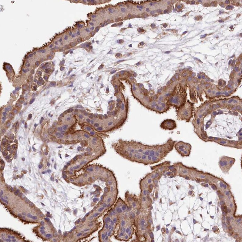 FCHO2 Antibody - BSA Free Immunohistochemistry: FCHO2 Antibody - BSA Free [NBP1-90904]