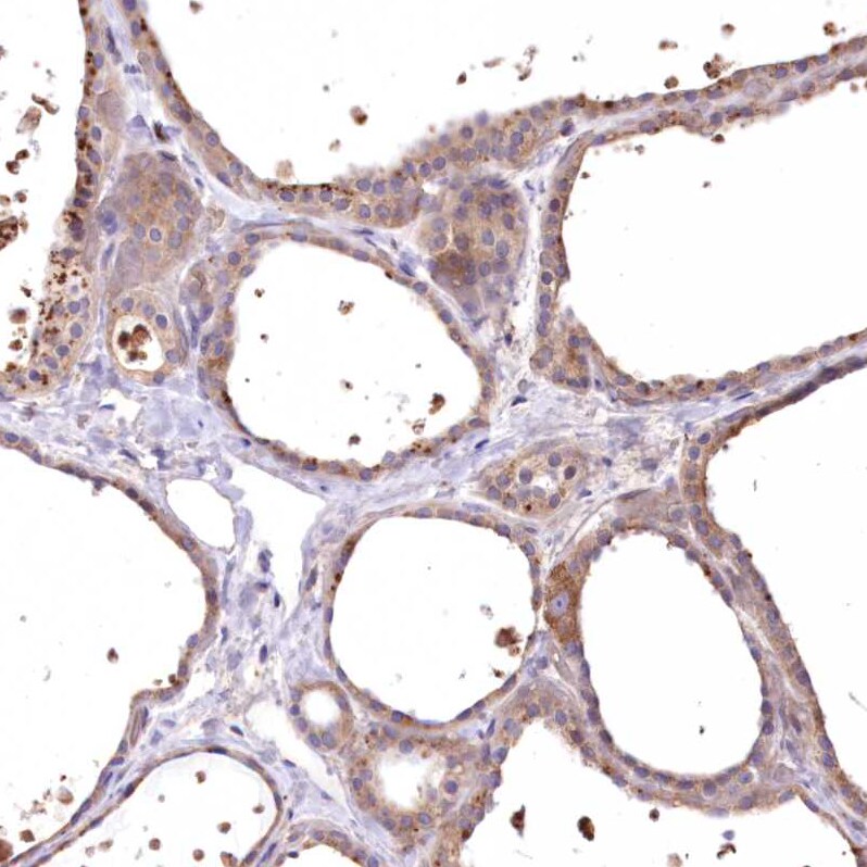 FCHO2 Antibody - BSA Free Immunohistochemistry: FCHO2 Antibody - BSA Free [NBP1-90904]