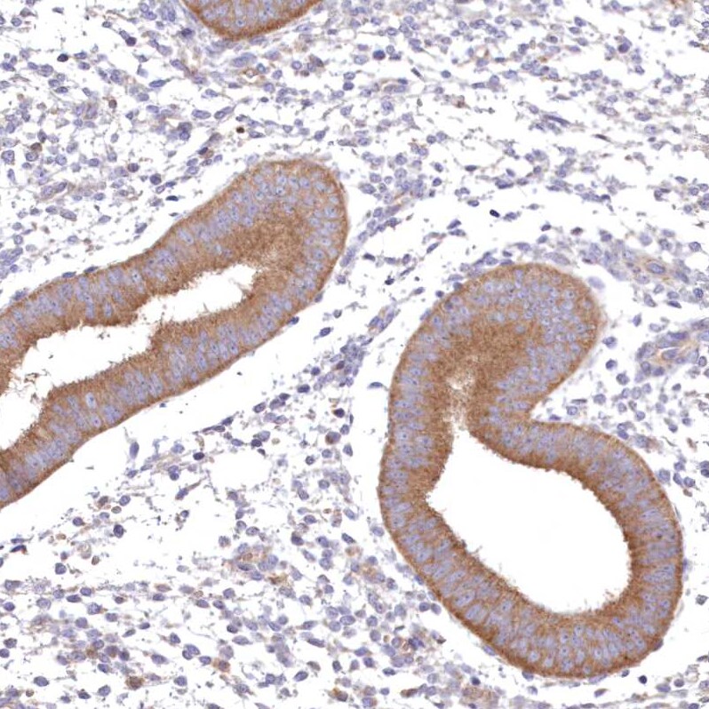 FCHO2 Antibody - BSA Free Immunohistochemistry: FCHO2 Antibody - BSA Free [NBP1-90904]