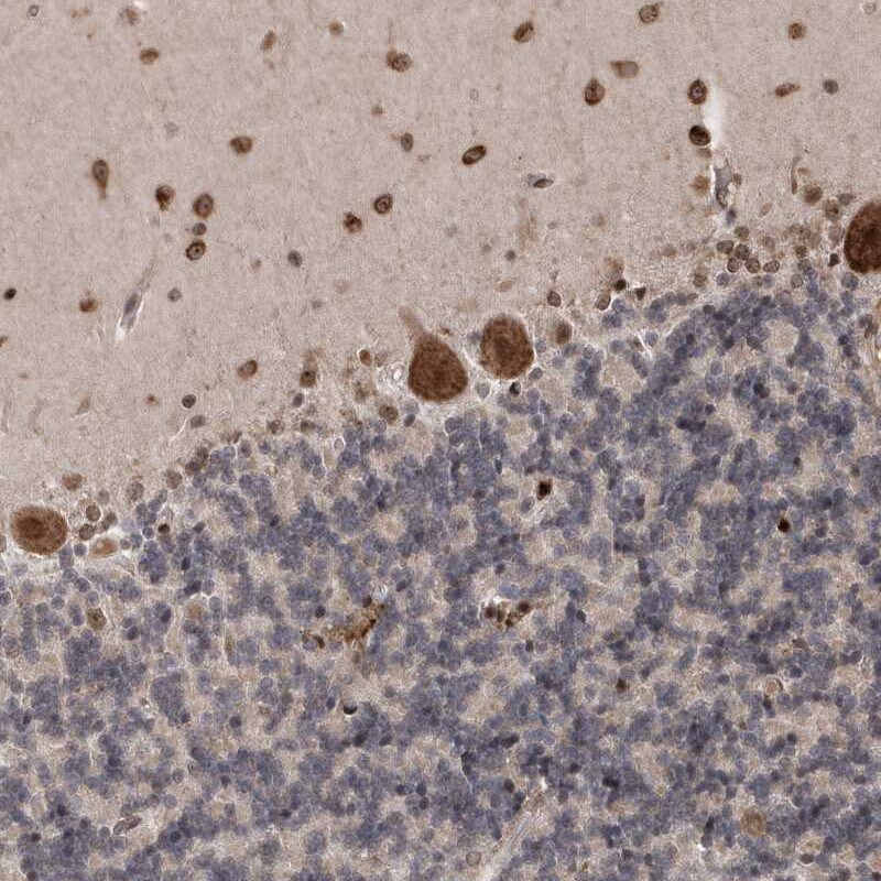 ANKRD56 Antibody - BSA Free Immunohistochemistry-Paraffin: ANKRD56 Antibody [NBP1-90905]