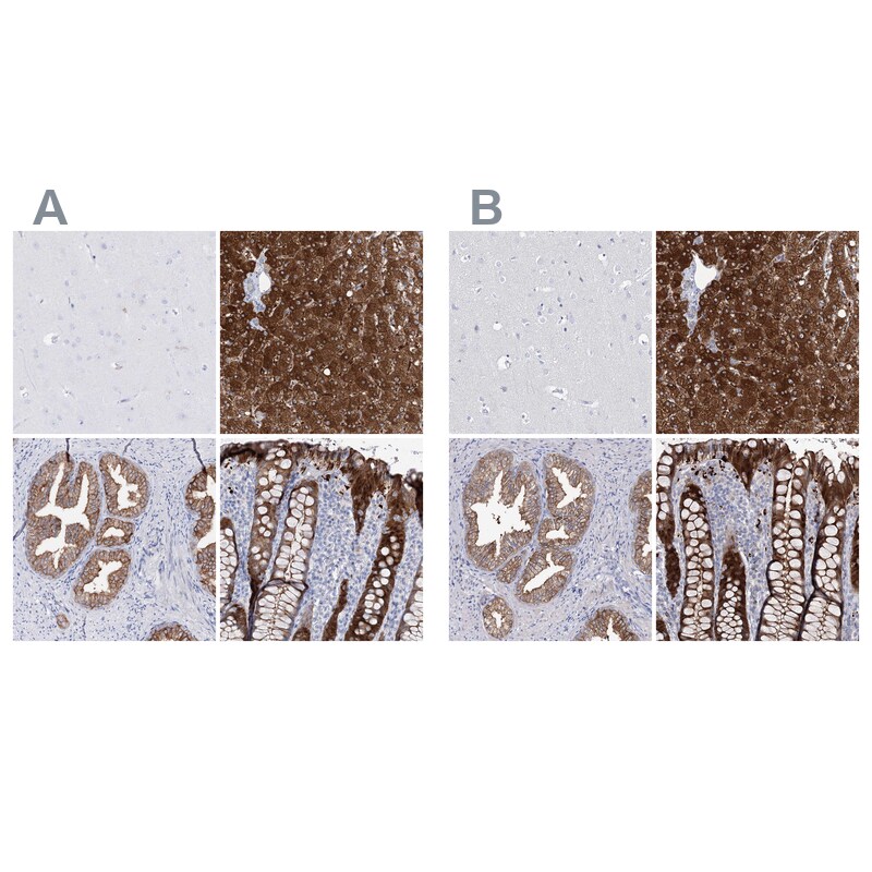 UDP glucose dehydrogenase Antibody - BSA Free Immunohistochemistry-Paraffin: UDP glucose dehydrogenase Antibody [NBP1-90906]