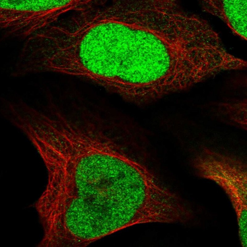 UDP glucose dehydrogenase Antibody - BSA Free Immunocytochemistry/ Immunofluorescence: UDP glucose dehydrogenase Antibody - BSA Free [NBP1-90906]