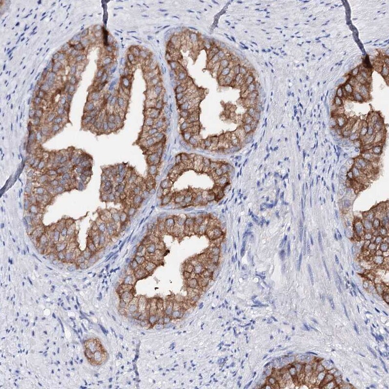 UDP glucose dehydrogenase Antibody - BSA Free Immunohistochemistry: UDP glucose dehydrogenase Antibody - BSA Free [NBP1-90906]