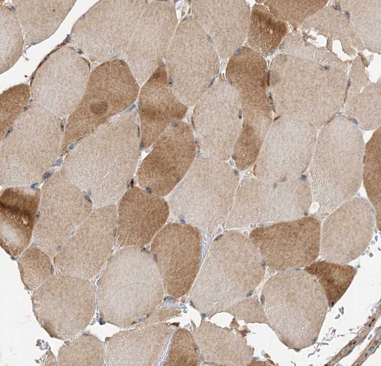 FEZ2 Antibody - BSA Free