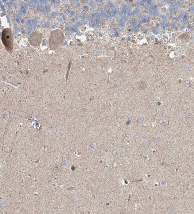 FEZ2 Antibody - BSA Free
