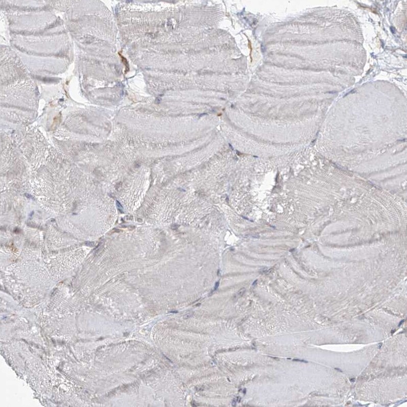 KIAA1522 Antibody - BSA Free Immunohistochemistry: KIAA1522 Antibody - BSA Free [NBP1-90915]