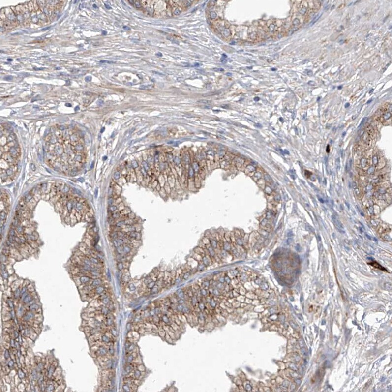 KIAA1522 Antibody - BSA Free Immunohistochemistry: KIAA1522 Antibody - BSA Free [NBP1-90915]