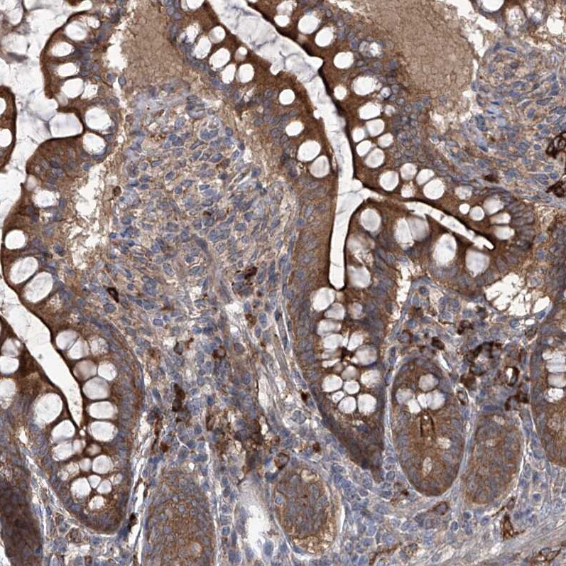 KIAA1522 Antibody - BSA Free Immunohistochemistry: KIAA1522 Antibody - BSA Free [NBP1-90915]