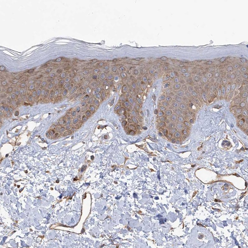 KIAA1522 Antibody - BSA Free Immunohistochemistry: KIAA1522 Antibody - BSA Free [NBP1-90915]