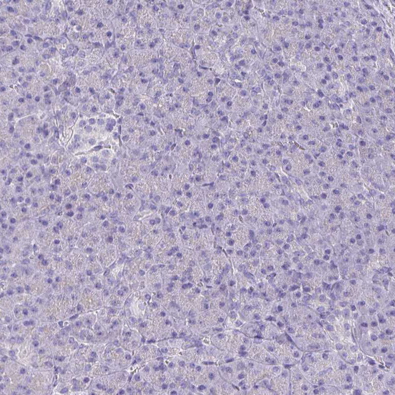 CFAP74 Antibody - BSA Free Immunohistochemistry: CFAP74 Antibody - BSA Free [NBP1-90921]