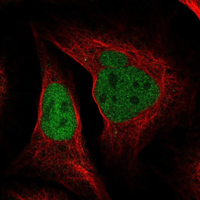DNA polymerase delta p50 Antibody - BSA Free Immunocytochemistry/ Immunofluorescence: DNA polymerase delta p50 Antibody [NBP1-90925]