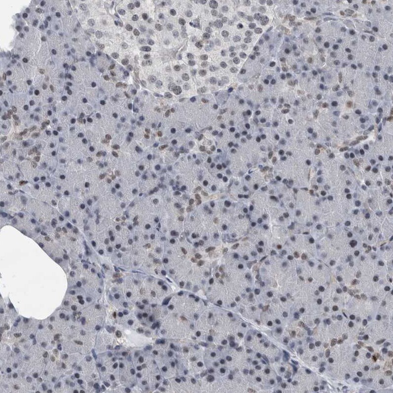 DNA polymerase delta p50 Antibody - BSA Free Immunohistochemistry: DNA polymerase delta p50 Antibody - BSA Free [NBP1-90925]