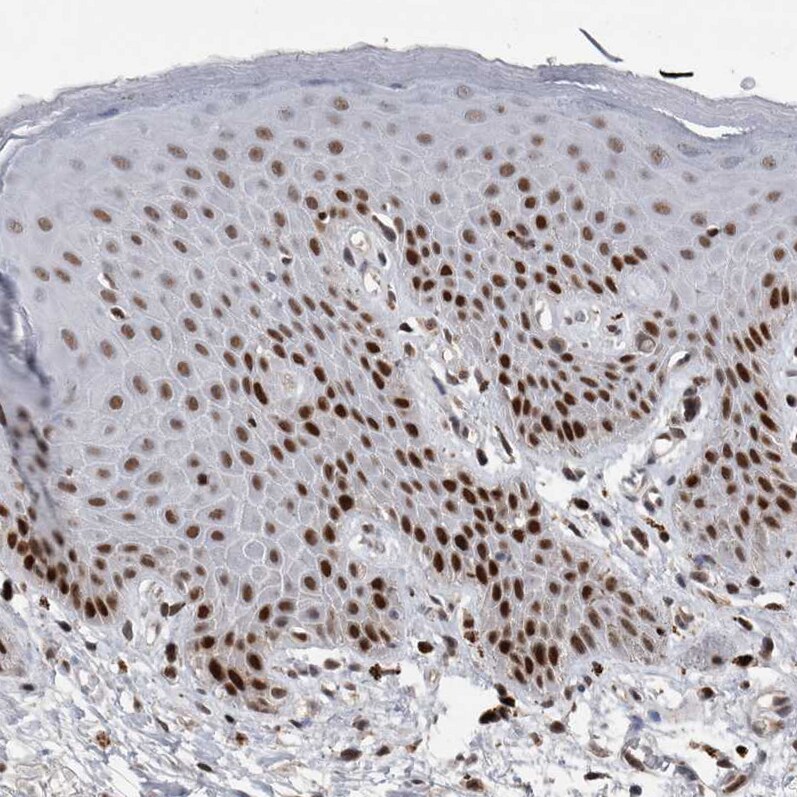 DNA polymerase delta p50 Antibody - BSA Free Immunohistochemistry: DNA polymerase delta p50 Antibody - BSA Free [NBP1-90925]