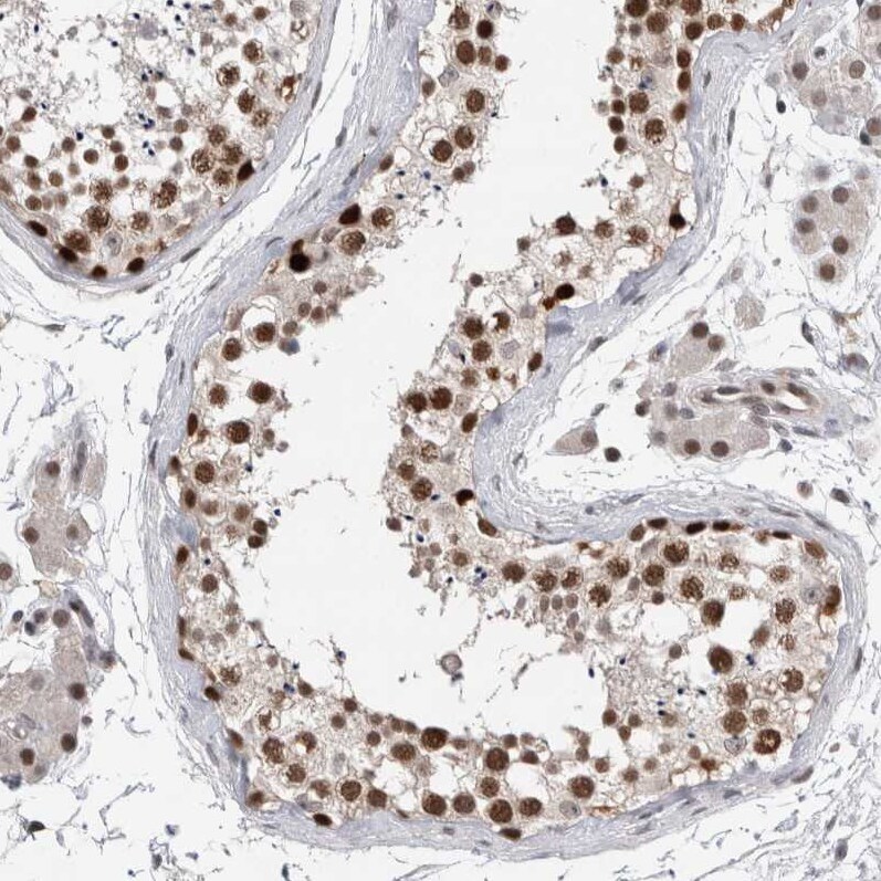 DNA polymerase delta p50 Antibody - BSA Free Immunohistochemistry: DNA polymerase delta p50 Antibody - BSA Free [NBP1-90925]