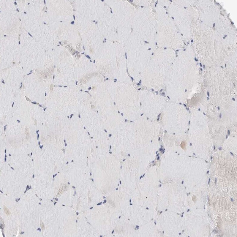SYTL5 Antibody - BSA Free Immunohistochemistry: SYTL5 Antibody - BSA Free [NBP1-90926]