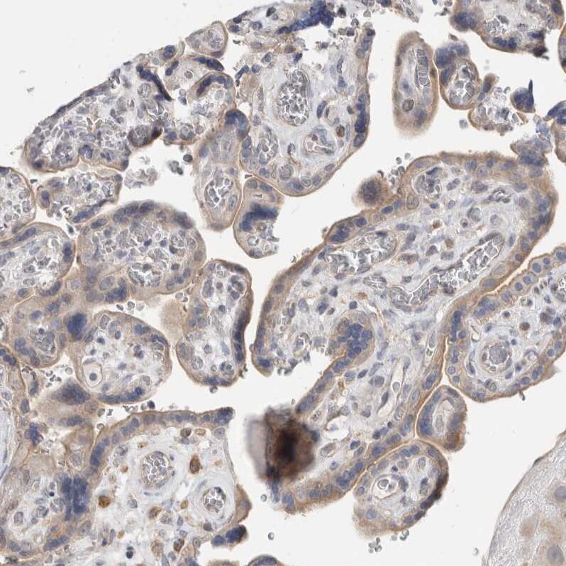 SYTL5 Antibody - BSA Free Immunohistochemistry: SYTL5 Antibody - BSA Free [NBP1-90926]