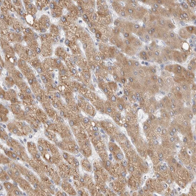SYTL5 Antibody - BSA Free Immunohistochemistry: SYTL5 Antibody - BSA Free [NBP1-90926]