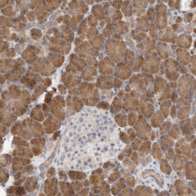 SYTL5 Antibody - BSA Free Immunohistochemistry: SYTL5 Antibody - BSA Free [NBP1-90926]