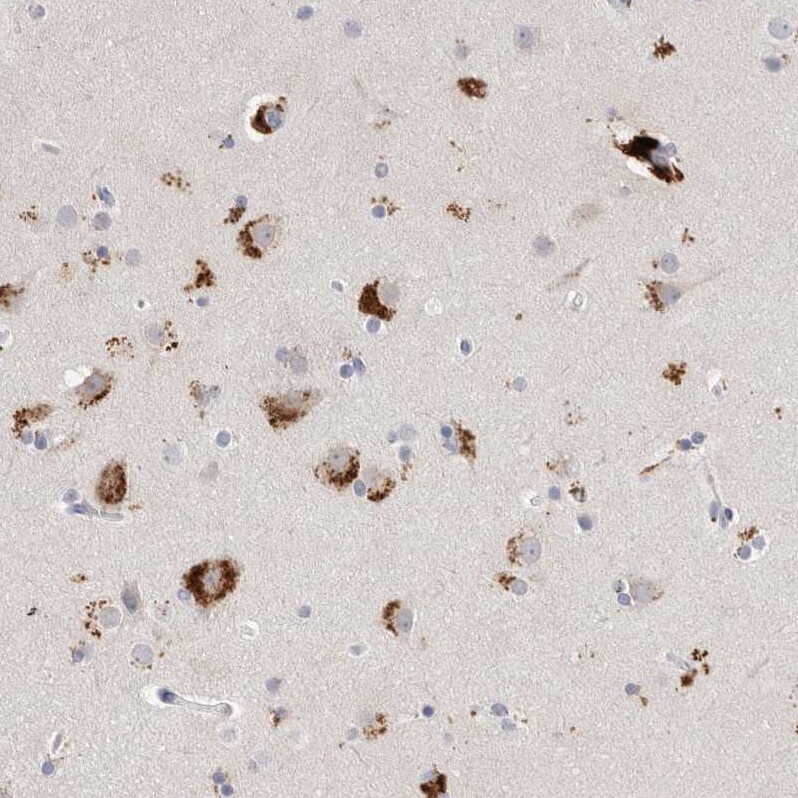 gamma-glutamyl hydrolase Antibody - BSA Free Immunohistochemistry: gamma-glutamyl hydrolase Antibody - BSA Free [NBP1-90927]