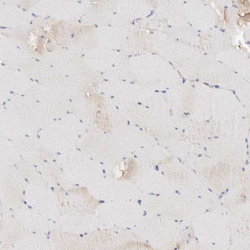gamma-glutamyl hydrolase Antibody - BSA Free Immunohistochemistry: gamma-glutamyl hydrolase Antibody - BSA Free [NBP1-90927]