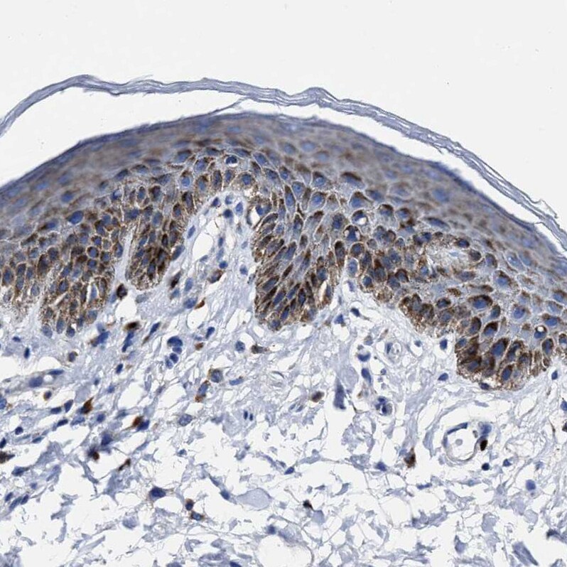 LAMTOR4 Antibody - BSA Free Immunohistochemistry: LAMTOR4 Antibody - BSA Free [NBP1-90936]