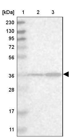 SPATC1L Antibody - BSA Free Western Blot: SPATC1L Antibody - BSA Free [NBP1-90939]
