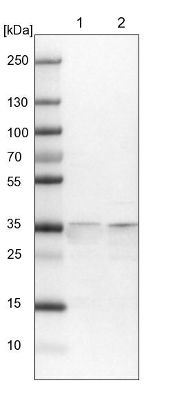 SPATC1L Antibody - BSA Free Western Blot: SPATC1L Antibody - BSA Free [NBP1-90939]