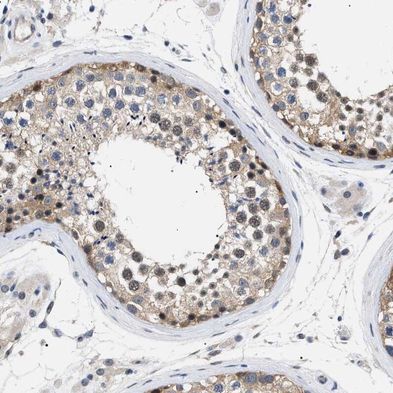 KIAA0355 Antibody - BSA Free Immunohistochemistry-Paraffin: KIAA0355 Antibody [NBP1-90943]