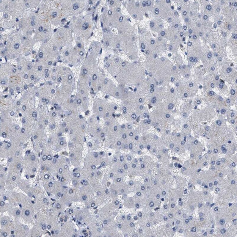 KIAA0355 Antibody - BSA Free Immunohistochemistry-Paraffin: KIAA0355 Antibody [NBP1-90943]