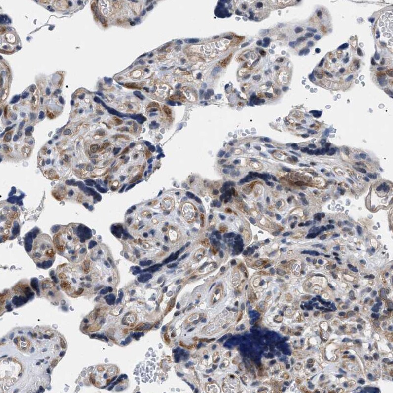 KIAA0355 Antibody - BSA Free Immunohistochemistry-Paraffin: KIAA0355 Antibody [NBP1-90943]