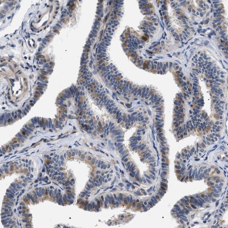 KIAA0355 Antibody - BSA Free Immunohistochemistry-Paraffin: KIAA0355 Antibody [NBP1-90943]